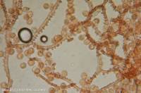 Attēlu rezultāti vaicājumam “Arcyria minuta”