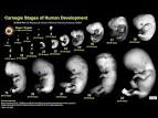 UNSW Embryology