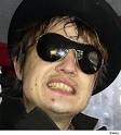 Pete Doherty Bad British Teeth