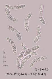 Attēlu rezultāti vaicājumam “Ruzenia spermoides”