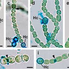Attēlu rezultāti vaicājumam “Nostoc pruniforme cells”