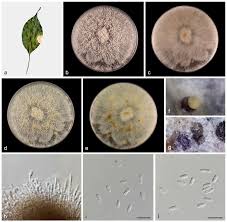Attēlu rezultāti vaicājumam “Diachea muscorum spores”