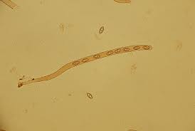 Attēlu rezultāti vaicājumam “Peziza badia”