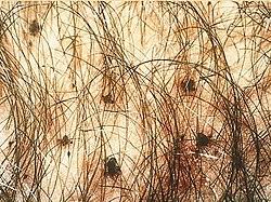 Image result for schamhaar