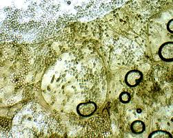 Attēlu rezultāti vaicājumam “Reticularia lobata spores”