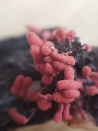 Attēlu rezultāti vaicājumam “Arcyria denudata young”