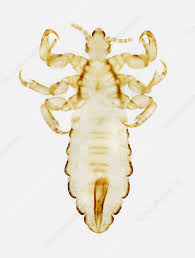 Attēlu rezultāti vaicājumam “Pediculus humanus capitis”