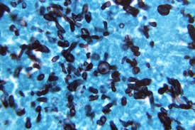 Attēlu rezultāti vaicājumam “Schistidium robustum sporophyte”