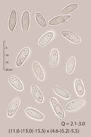 Attēlu rezultāti vaicājumam “Cudoniella clavus”