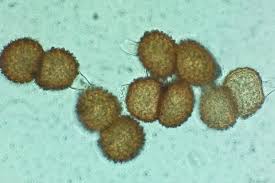 Attēlu rezultāti vaicājumam “Tranzschelia anemones”