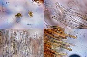 Attēlu rezultāti vaicājumam “Lachnella alboviolascens”