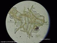 Attēlu rezultāti vaicājumam “Arcyria affinis spores”