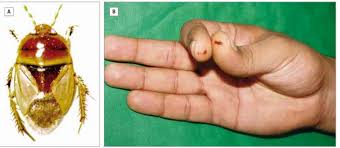 Attēlu rezultāti vaicājumam “Cydnidae”