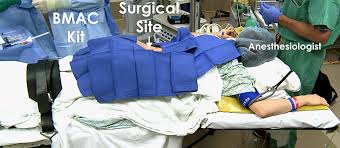 Image result for BMAC