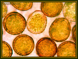 Attēlu rezultāti vaicājumam “Uromyces dactylidis”