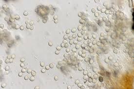 Attēlu rezultāti vaicājumam “Dianema nivale spores”