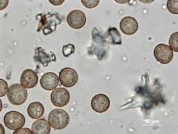 Attēlu rezultāti vaicājumam “Didymium serpula macro”