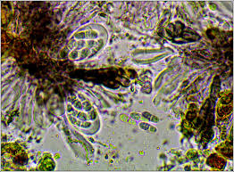 Attēlu rezultāti vaicājumam “Arthonia vinosa”