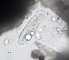 Attēlu rezultāti vaicājumam “Pertusaria flavida”