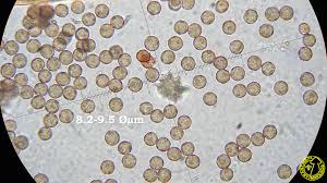 Attēlu rezultāti vaicājumam “Didymium megalosporum spores”