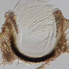 Attēlu rezultāti vaicājumam “Stictis”