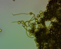 Attēlu rezultāti vaicājumam “Trichia varia”