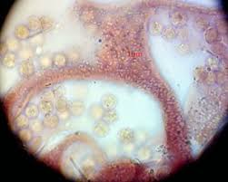 Attēlu rezultāti vaicājumam “Lycogala ustulatum macro”