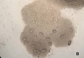 Attēlu rezultāti vaicājumam “Hemitrichia serpula spores”