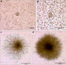 Attēlu rezultāti vaicājumam “Enteridium corticatum spores”