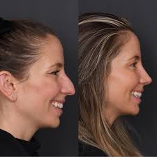 Attēlu rezultāti vaicājumam “Pandemis cinnamomeana female”