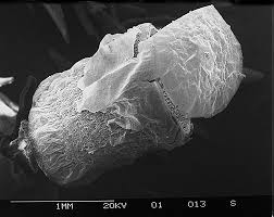 Attēlu rezultāti vaicājumam “Sphagnum sporophyte”