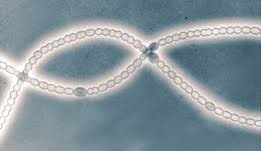 Attēlu rezultāti vaicājumam “Nostoc pruniforme cells”