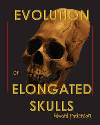 Image result for elongated skulls