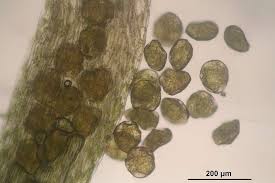 Attēlu rezultāti vaicājumam “Blasia pusilla”