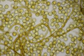 Attēlu rezultāti vaicājumam “Trichia botrytis”