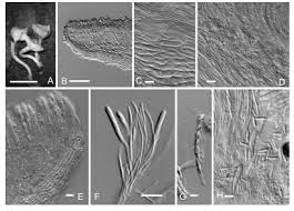 Attēlu rezultāti vaicājumam “Hymenoscyphus fructigenus”
