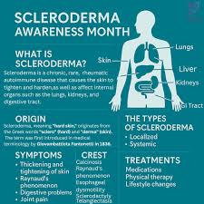 Attēlu rezultāti vaicājumam “Scleroderma”