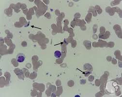 Attēlu rezultāti vaicājumam “Cribraria purpurea plasmodium”