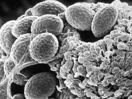 Attēlu rezultāti vaicājumam “Ascomycota”