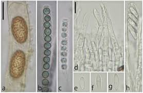Attēlu rezultāti vaicājumam “Sowerbyella radiculata”