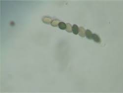 Attēlu rezultāti vaicājumam “Sordaria fimicola”