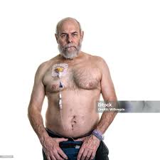 Image result for brust pumpe