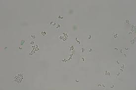 Attēlu rezultāti vaicājumam “Sidera lenis”