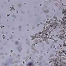 Attēlu rezultāti vaicājumam “Penicillium vulpinum”