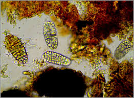 Attēlu rezultāti vaicājumam “Phlyctis agelaea”