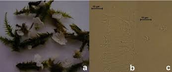 Attēlu rezultāti vaicājumam “Rimbachia neckerae”