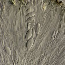 Attēlu rezultāti vaicājumam “Porpidia macrocarpa”