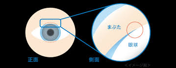 「ワンデーアキュビュートゥルーアイ　曇る」の画像検索結果