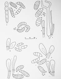 Attēlu rezultāti vaicājumam “Dacrymyces chrysospermus spores”