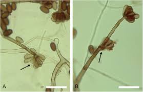 Attēlu rezultāti vaicājumam “Badhamia versicolor spores”